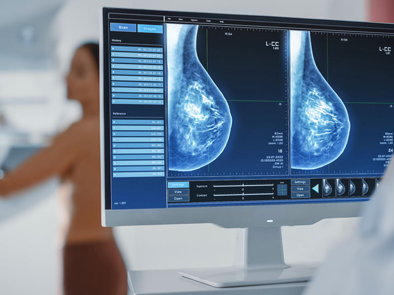 Your First Mammogram - When & Why? | Dr. Ritu Dave explains